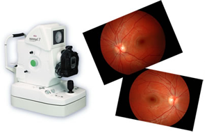 Digital Fundus Photography